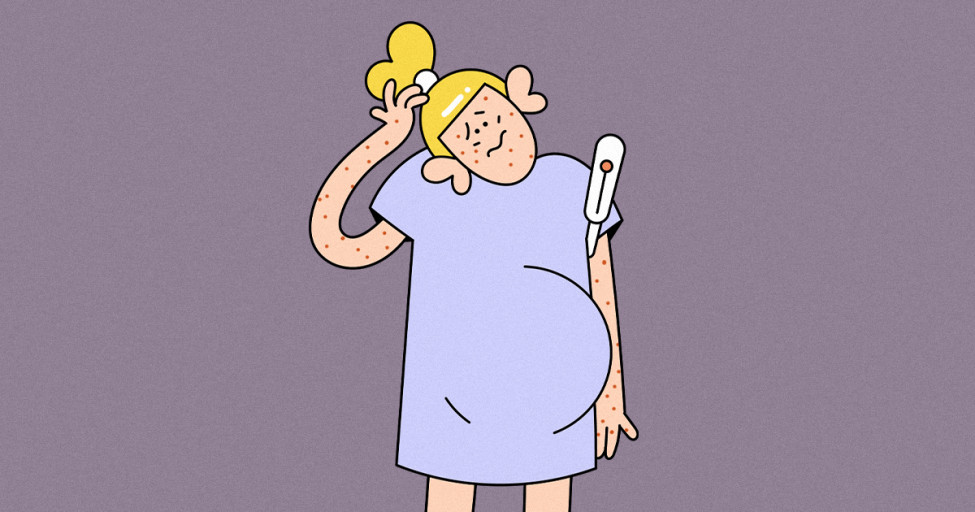 8 неожиданных болезней, которые могут проявиться во время беременности