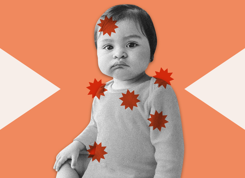 На картинке: ребенок покрыт оранжевыми многоугольниками. Коллаж Насти Железняк для НЭН