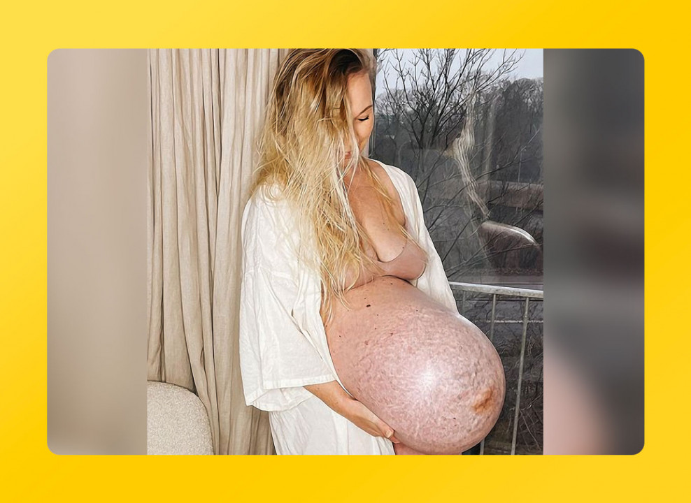 26 неделя беременности фото малыша и твои изменения — Евромедклиник 24