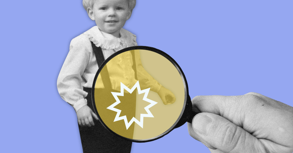 Фимоз, мегауретер, гидронефроз. Урологические заболевания, которые ...