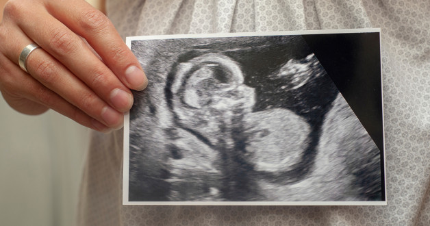 Фото: Olha Birieva | Shutterstock | Fotodom