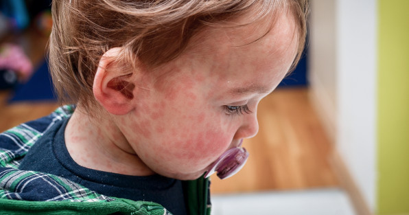 Фото: JGA | Shutterstock | Fotodom