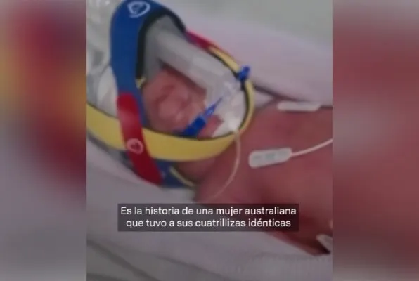 Австралийка родила редчайших однояйцевых четверняшек